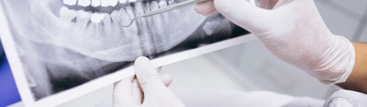 2021-09-Dental-Arca-Dente-Scheggiato